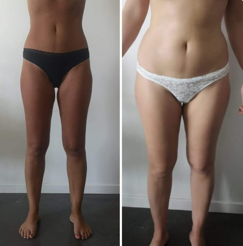 Massage Minceur/Anti-Cellulite